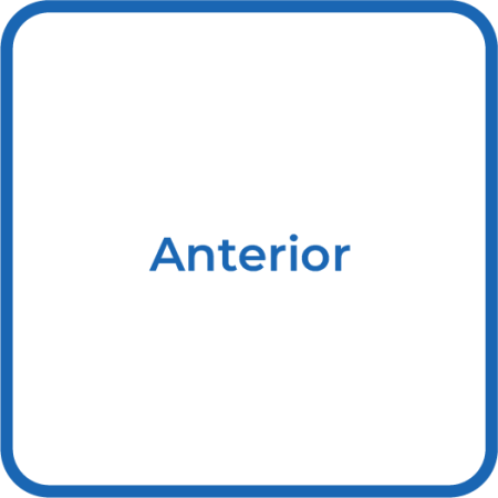 Oper_Anterior