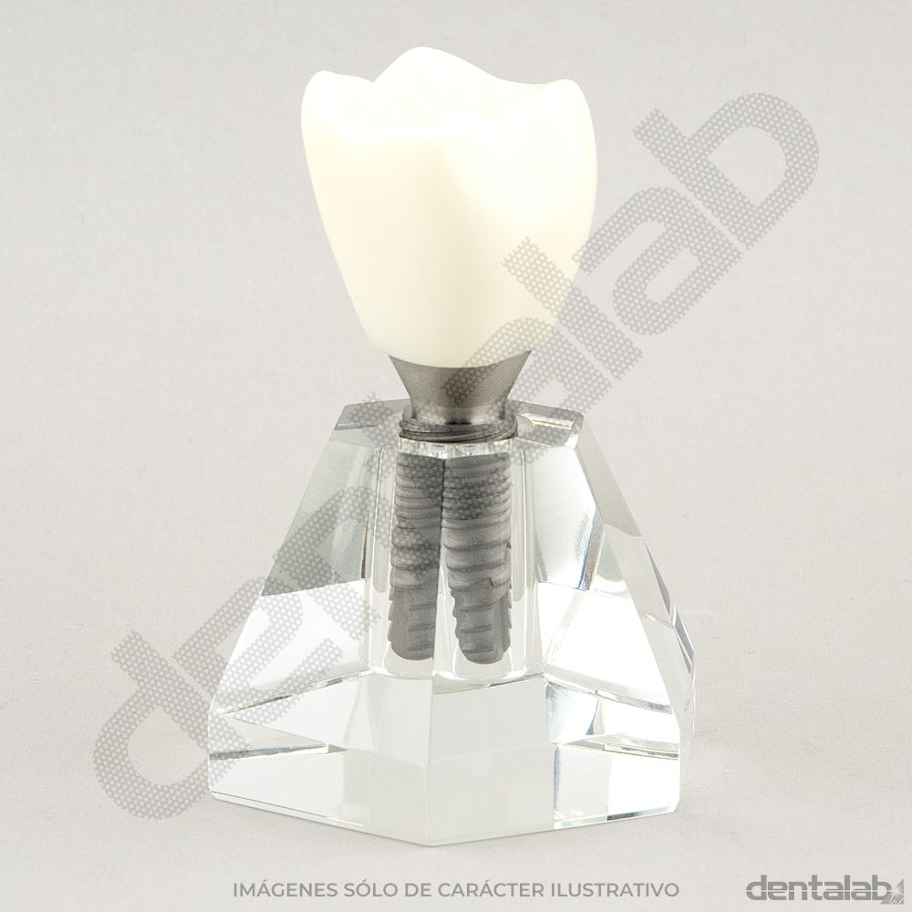 MacroModelo 1 Pieza (Implante con Corona)