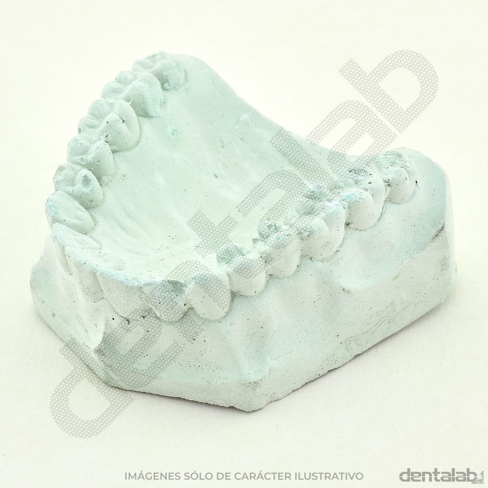 Modelo de Yeso Dentado x Par