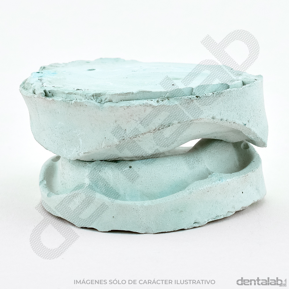 Modelo de Yeso Desdentado x Par