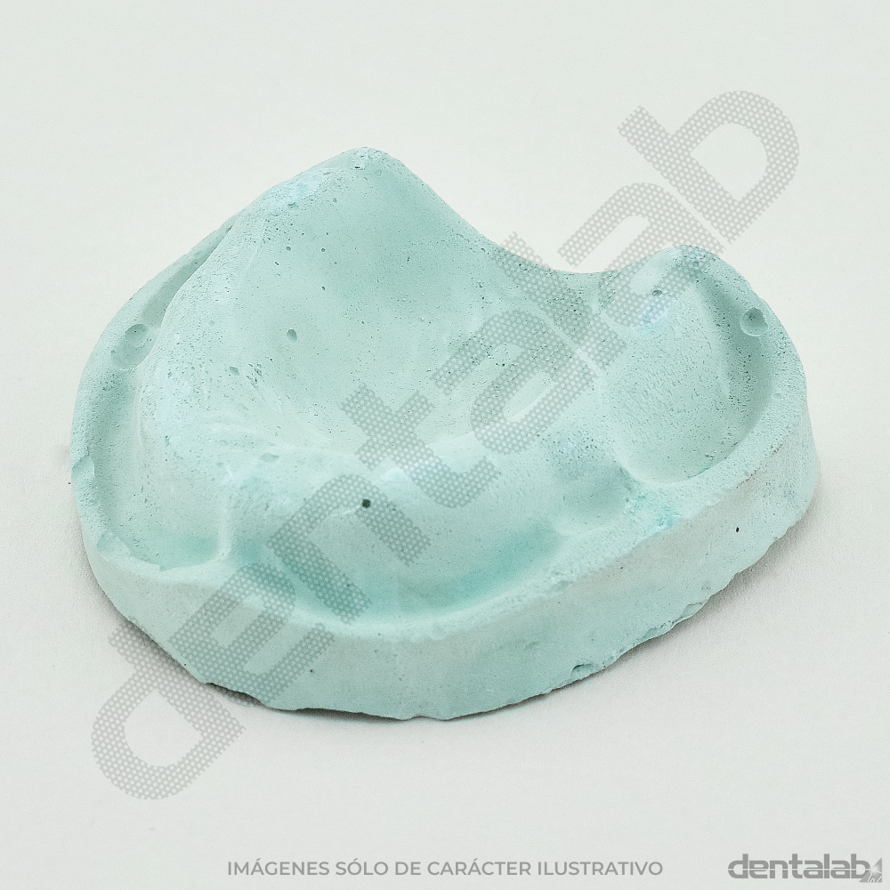 Modelo de Yeso Desdentado x Par