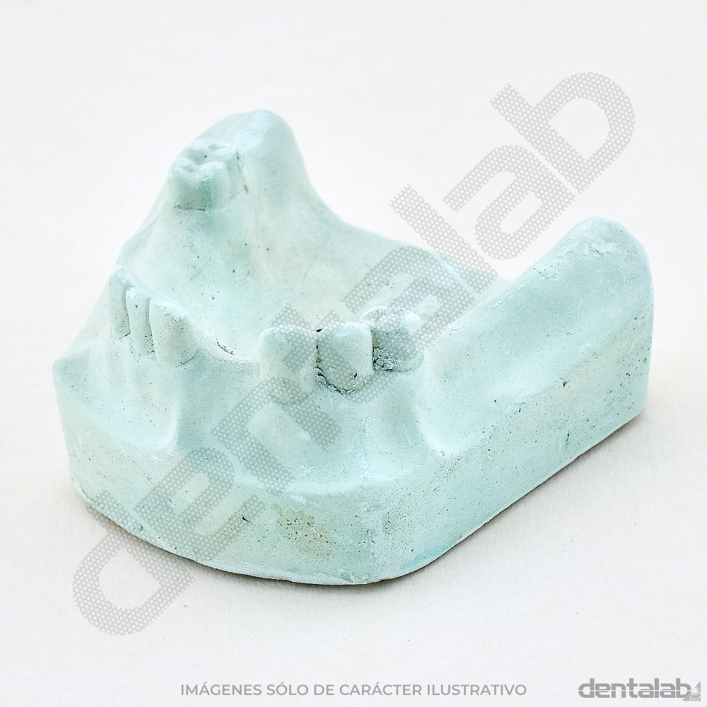 Modelo de Yeso Parcialmente Dentado x Par