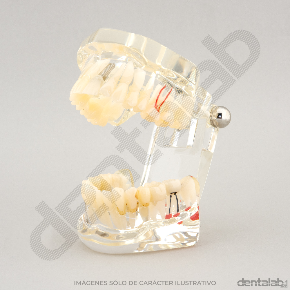 Macromodelo Articulado Acrílico Transparente (con Raíces)