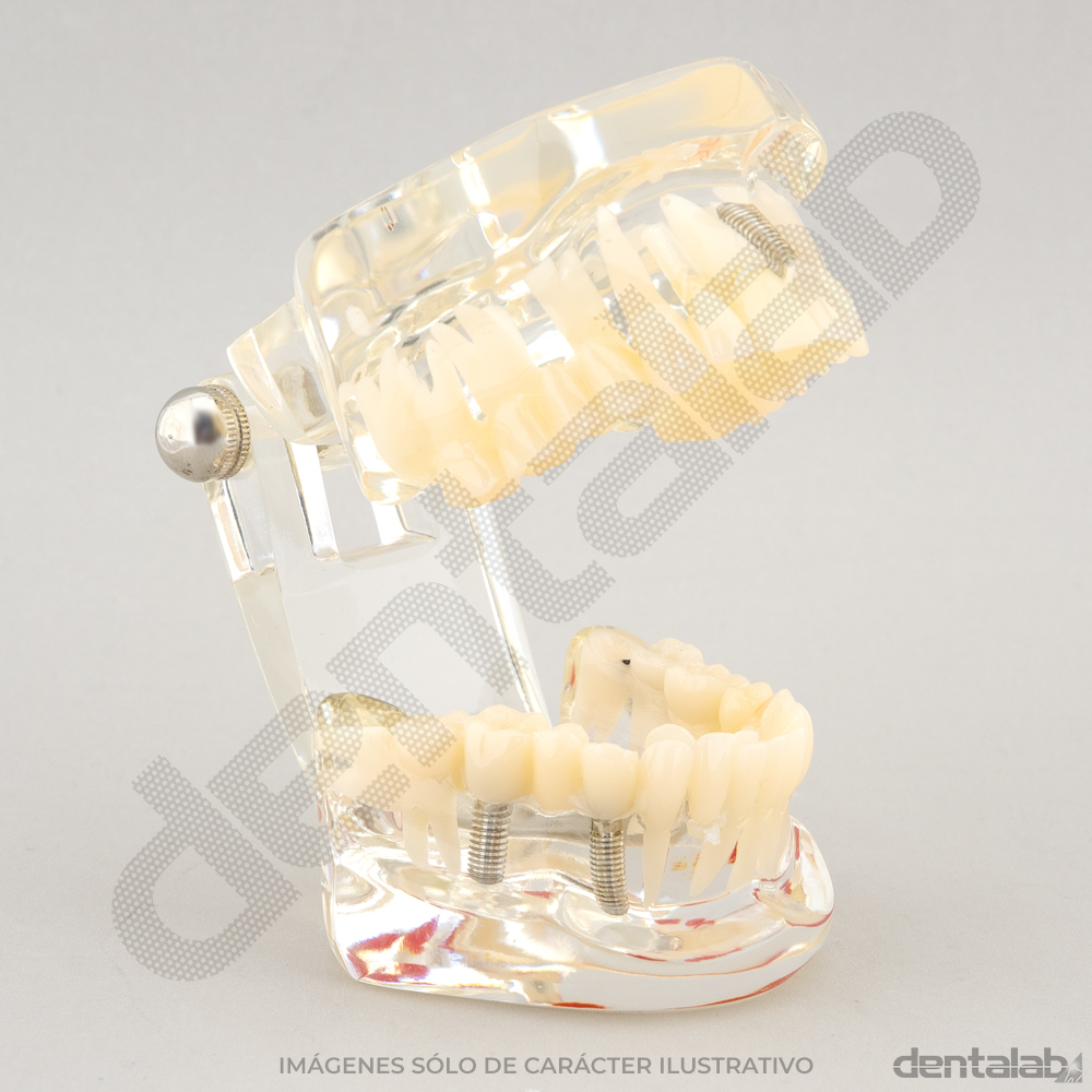 Macromodelo Articulado Acrílico Transparente (con Raíces)