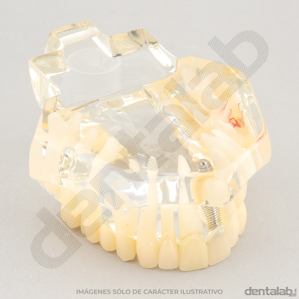 Macromodelo Articulado Acrílico Transparente (con Raíces)