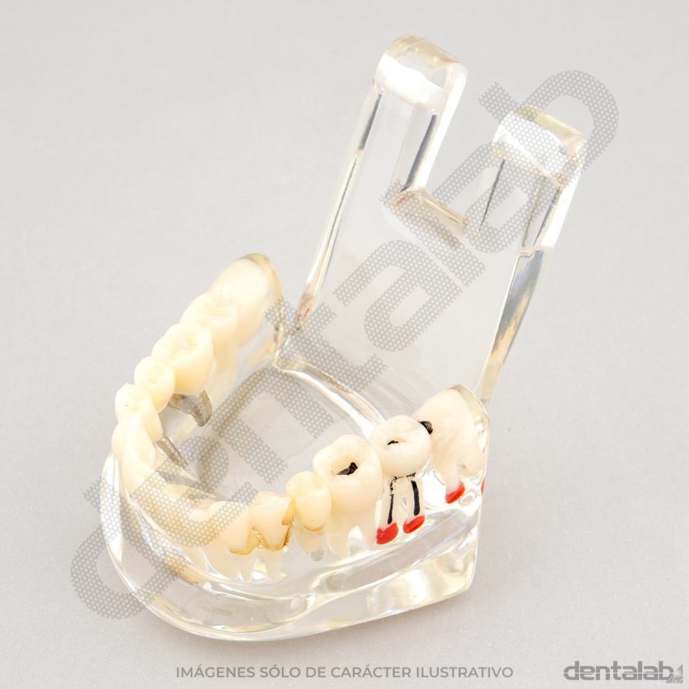 Macromodelo Articulado Acrílico Transparente (con Raíces)