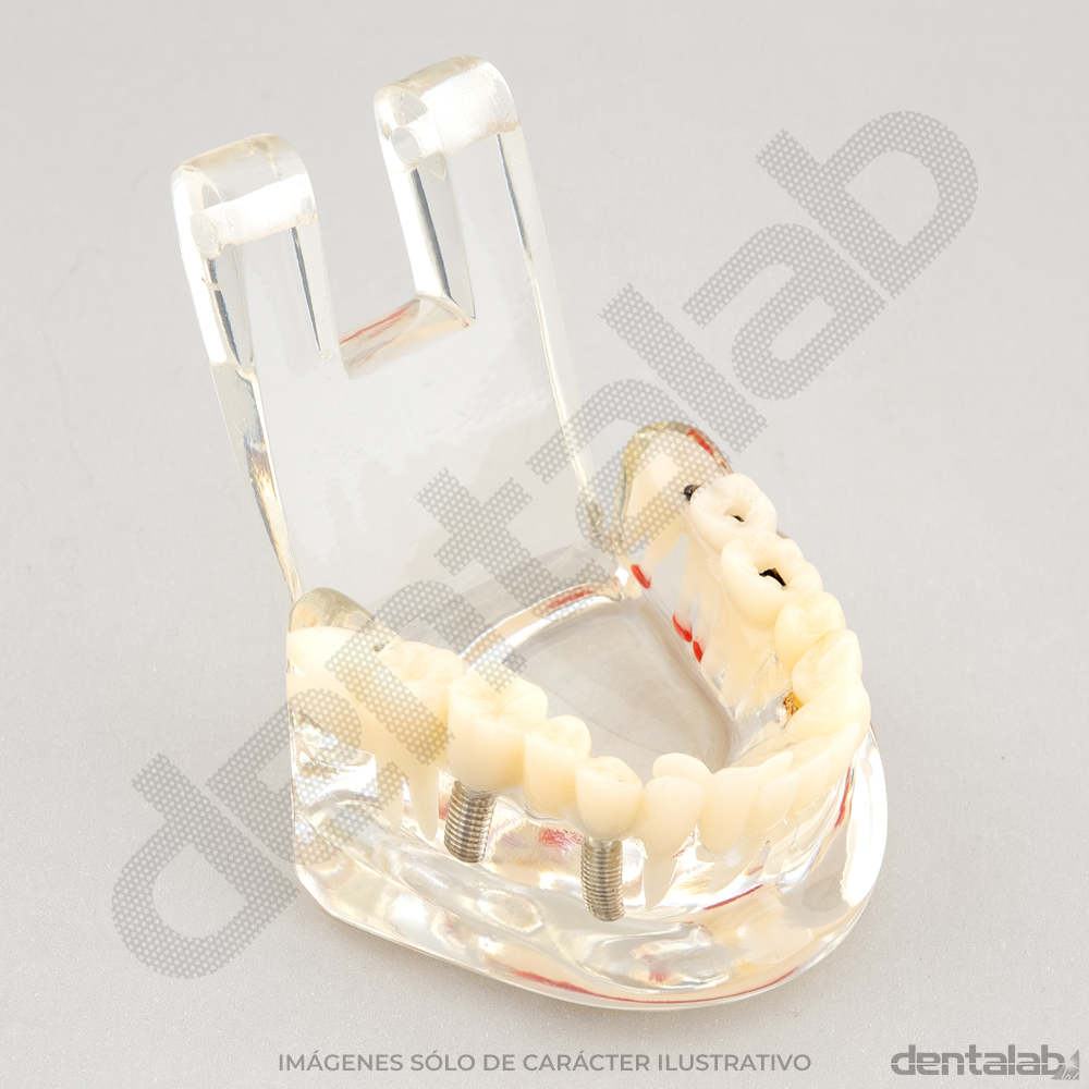 Macromodelo Articulado Acrílico Transparente (con Raíces)