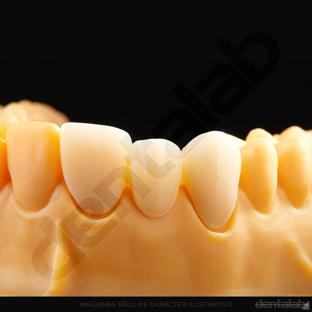 Disco de Zirconio RONDCERA SHT-ML PRO 3D A2 98 X 12mm